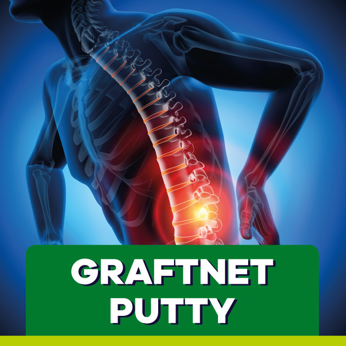 GraftNet Putty