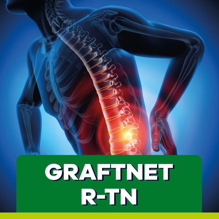 GraftNet R-TN